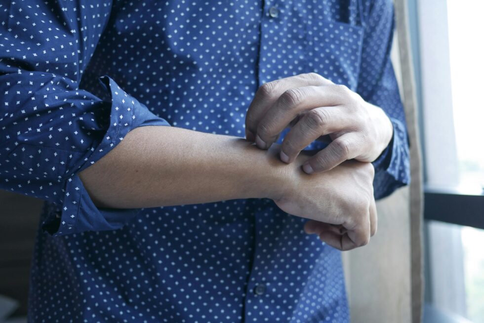 A person with allergy symptom skin itching