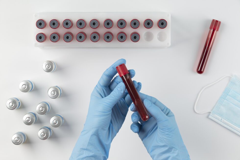 A healthcare professional in blue gloves holds a blood sample tube, surrounded by laboratory vials and medical supplies