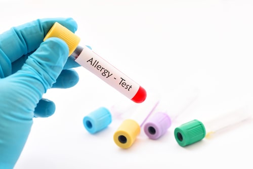 allergy test