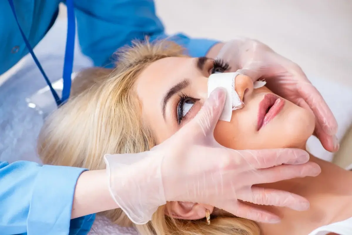 rhinoplasty