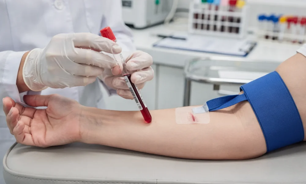 CBC and differential blood test